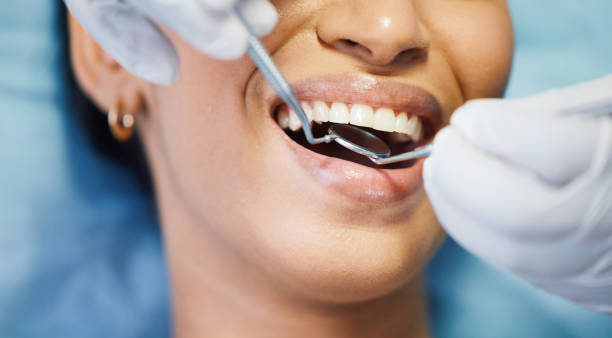 Best Emergency Treatment for Dental Infections or Abscesses in Coral Gables, FL